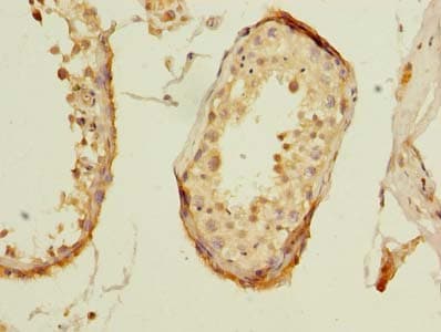ZNF614 Antibody