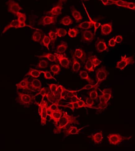 Polyclonal Rabbit anti-Human ABCF2 Antibody (IF, WB)
