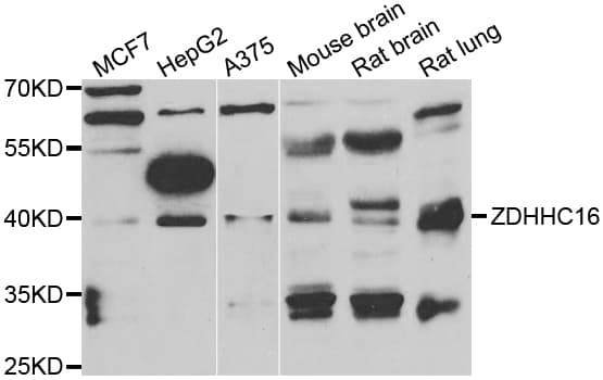ZDHHC16 Antibody