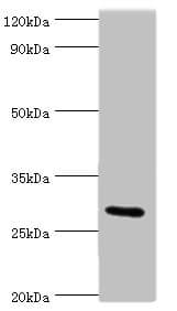 Polyclonal Rabbit anti-Human COLEC11 Antibody (aa26-271, IHC, WB)