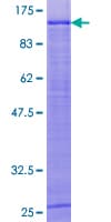 Human ELAC2 Protein (Recombinant GST)