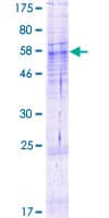 Human ABHD13 Protein (Recombinant GST)