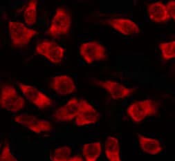 Polyclonal Rabbit anti-Human OR5M3 Antibody (IF, WB)