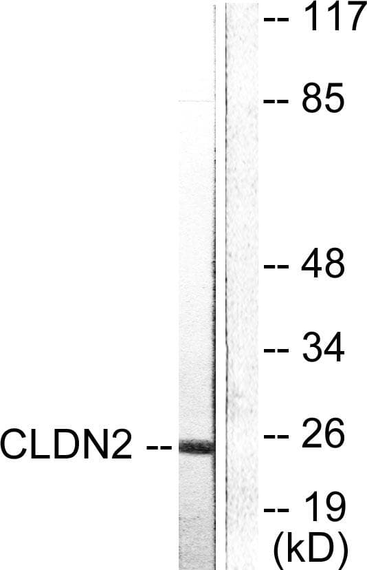 CLDN2 / Claudin 2 Antibody