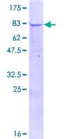 Human TRMT2B Protein (Recombinant GST)
