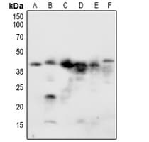 NACA Antibody (phospho-S43)