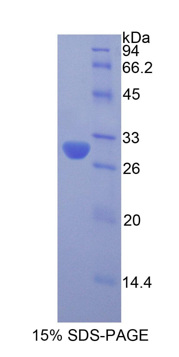 Rat Acrosin Protein (Recombinant His)