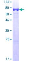Human Vimentin Protein (Recombinant GST)