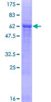 Human PTER Protein (Recombinant GST)