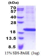Human RPS18 / Ribosomal Protein S18 (Recombinant His)