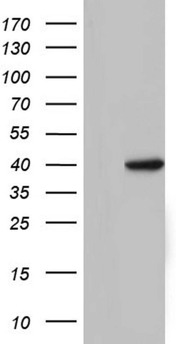 Monoclonal Mouse anti-Human TFB1M Antibody (clone OTI13H2, aa116-346, WB)