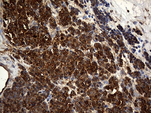 ACTR3 Antibody (aa2-418, clone OTI5G4)