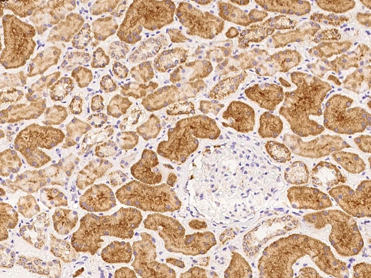 IRAK2 / IRAK-2 Antibody