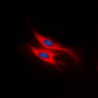 Polyclonal Rabbit anti-Human ACKR4 / CCRL1 / CCR11 Antibody (N-Terminus, IF, WB)