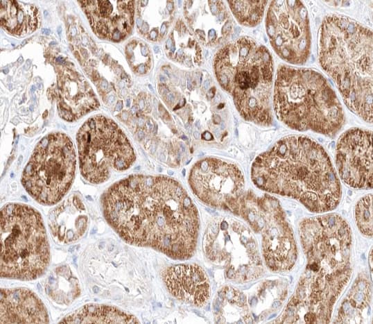 TGFB3 / TGF Beta3 Antibody