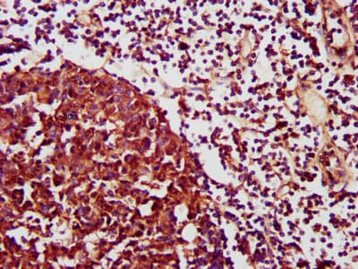 Polyclonal Rabbit anti-Human CXCR3 Antibody (IHC, IF, WB)