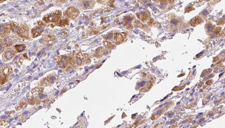 RFTN2 Antibody