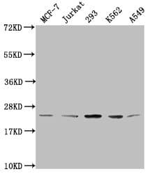 HIST1H1C Antibody