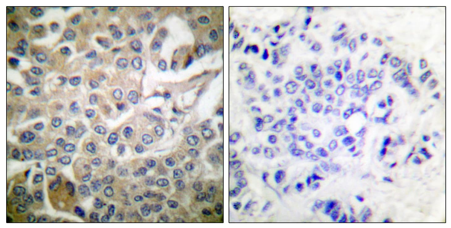 RAC1 Antibody (Internal)