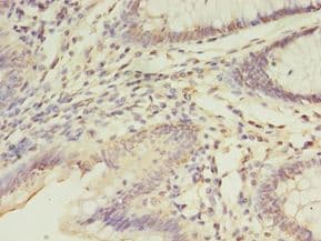 FGL2 Antibody (Biotin)