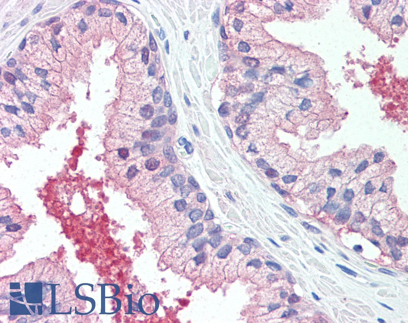 IHC-plus™ CADM2 Antibody (Extracellular Domain)