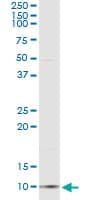 Monoclonal Mouse anti-Human CCL18 / PARC Antibody (clone 2C6, WB)