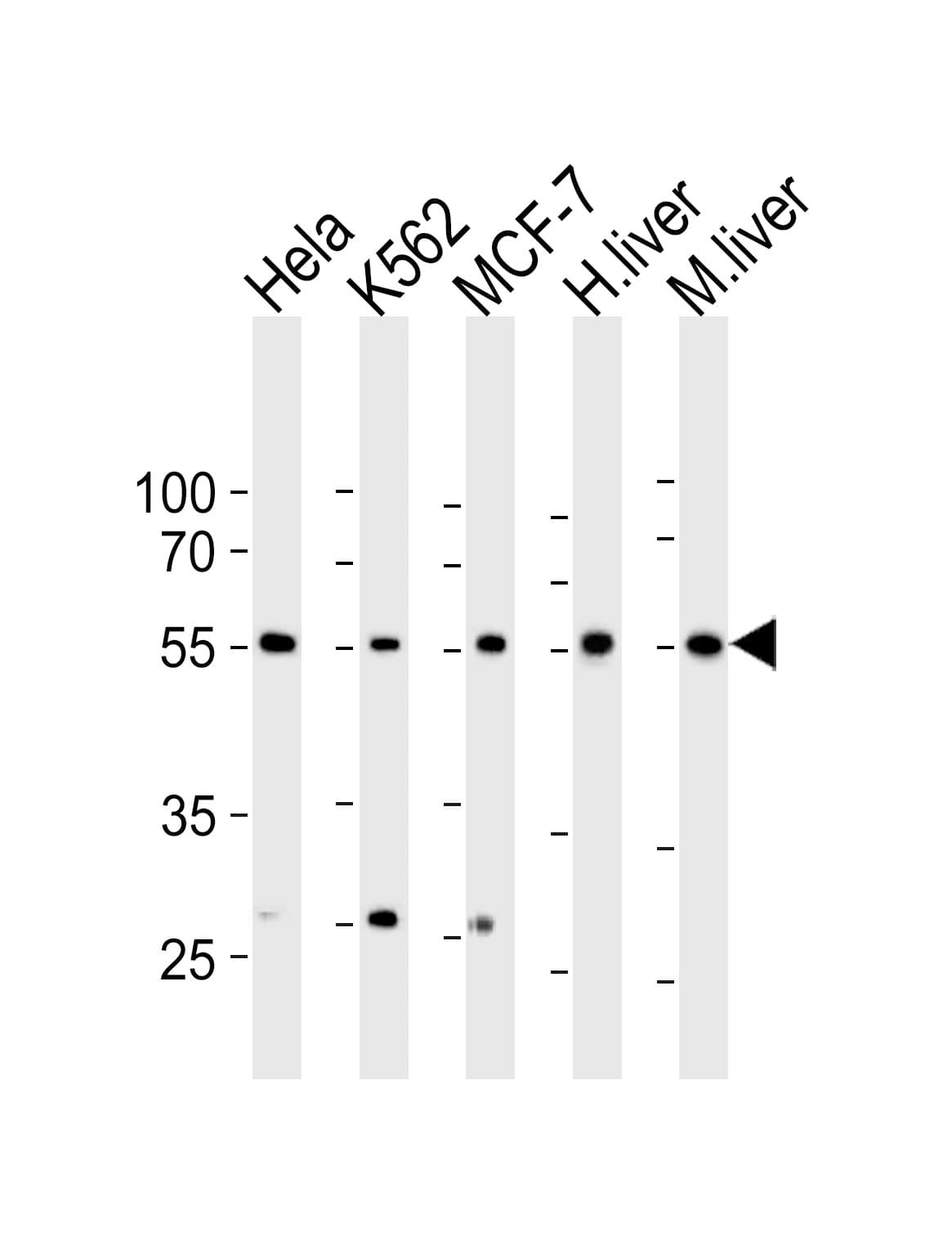 ALK3 / BMPR1A Antibody (aa1-30)