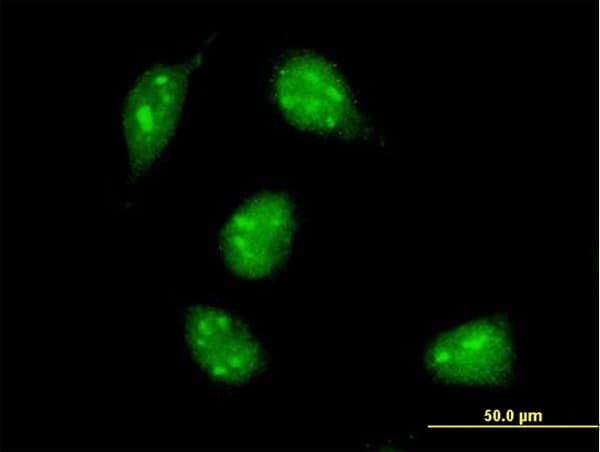 MAX Antibody (clone 4E10-1A9)