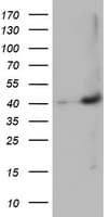 MAGEB18 Antibody (clone OTI9F9)