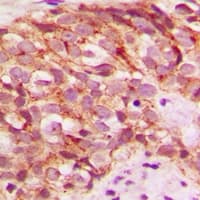 GLYCTK / Glycerate Kinase Antibody (Internal)