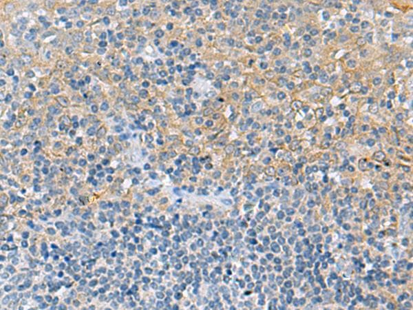 Polyclonal Rabbit anti-Human LRAT Antibody (IHC, WB)