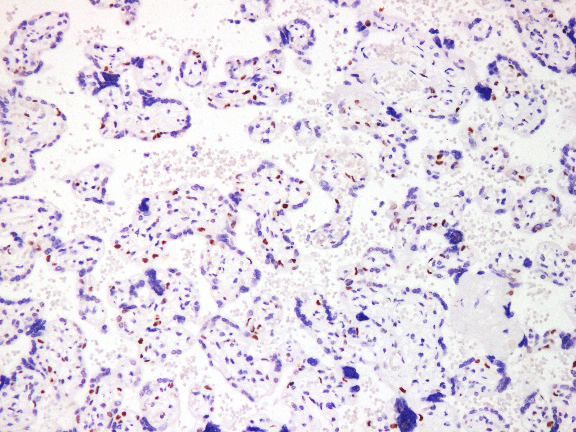 CORO1A / Coronin 1a Antibody