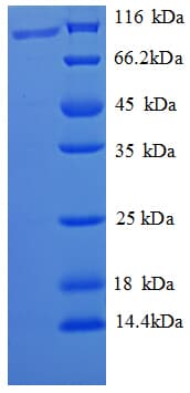 Nosema bombycis PTP3 Protein (Recombinant GST)