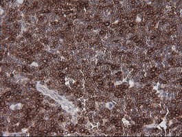 CD1C Antibody (clone OTI1F4)