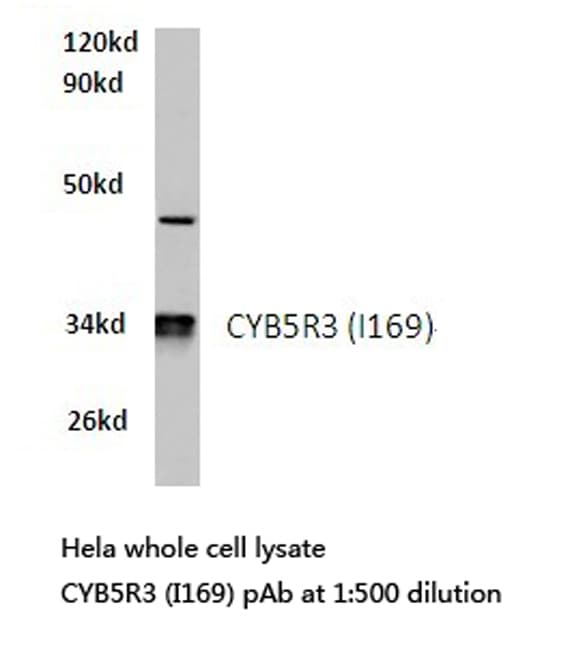 Polyclonal Rabbit anti-Human CYB5R3 / B5R Antibody (Ile169, IHC, WB)