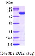 Human CKB / Creatine Kinase BB Protein (Recombinant His)