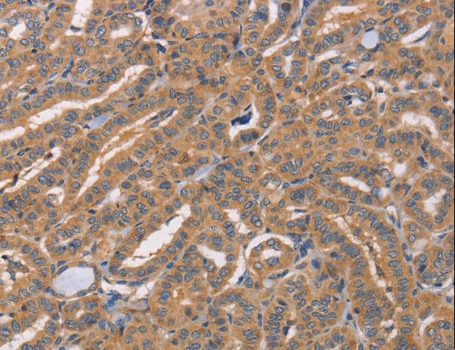 Polyclonal Rabbit anti-Human CDCA4 Antibody (IHC)