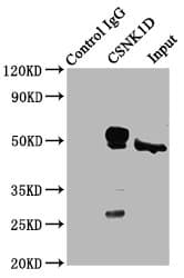 Polyclonal Rabbit anti-Human CSNK1D Antibody (IHC)