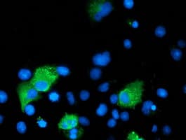 ARFGAP1 Antibody (clone OTI2D5)