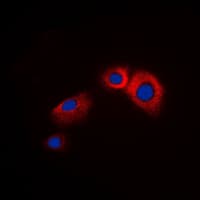 ARRB1 / Beta Arrestin 1 Antibody (C-Terminus)