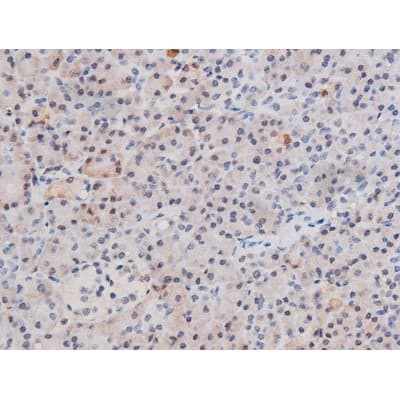 STAT3 Antibody (phospho-Ser727)