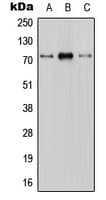 SLC28A1 Antibody (Internal)