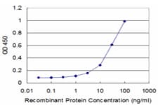 Monoclonal Mouse anti-Human RPL30 / Ribosomal Protein L30 Antibody (clone 4E6, WB)