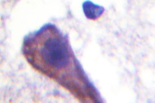 GNAZ Antibody (Ala12)