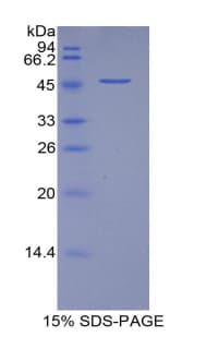 Pig VEGFA / VEGF Protein (Recombinant His-GST)