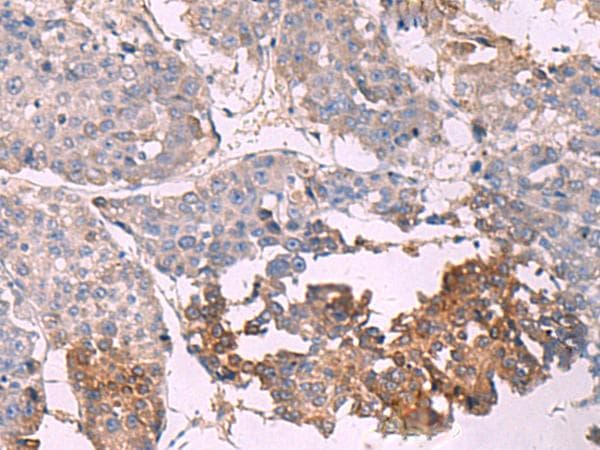 NIPSNAP1 Antibody