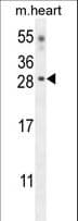 CLDN6 / Claudin 6 Antibody (aa130-159)