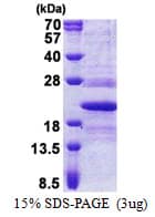 Human TMED10 / TMP21 Protein (Recombinant His)