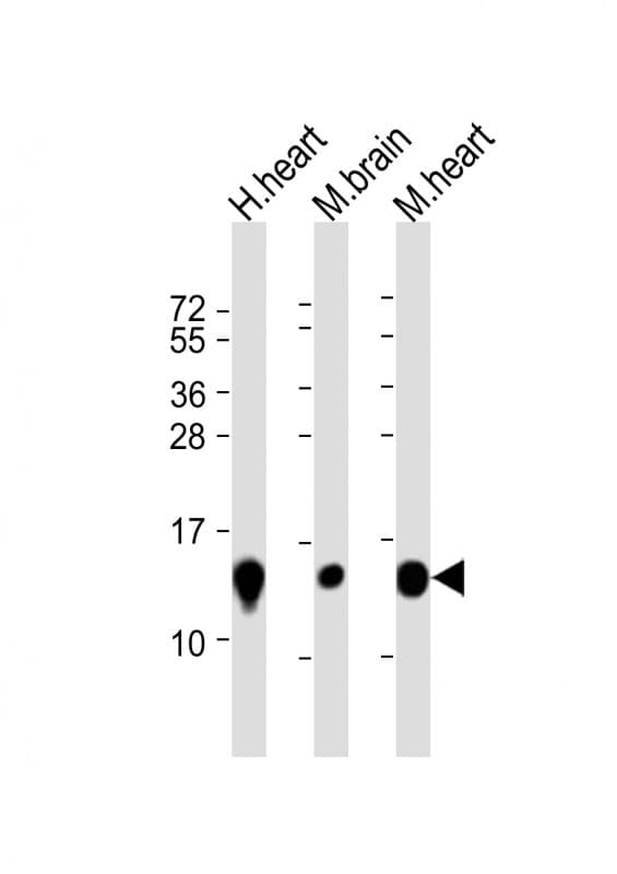 Polyclonal Rabbit anti-Human NDUFB3 Antibody (aa13-45, WB)