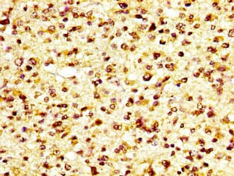 GP6 / GPVI Antibody